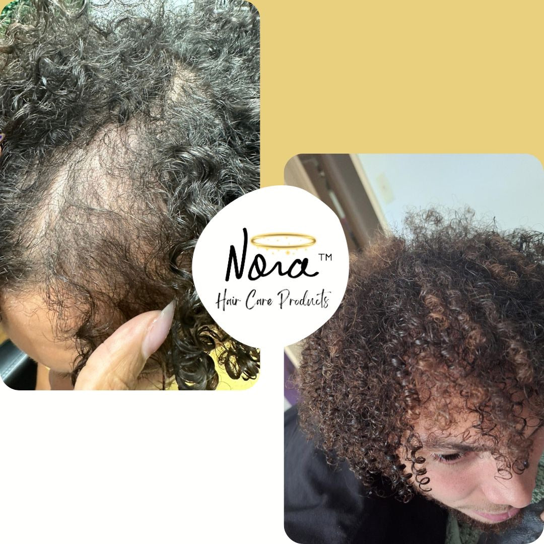 Nora's Extra Strength ReGrowth Hair Serum