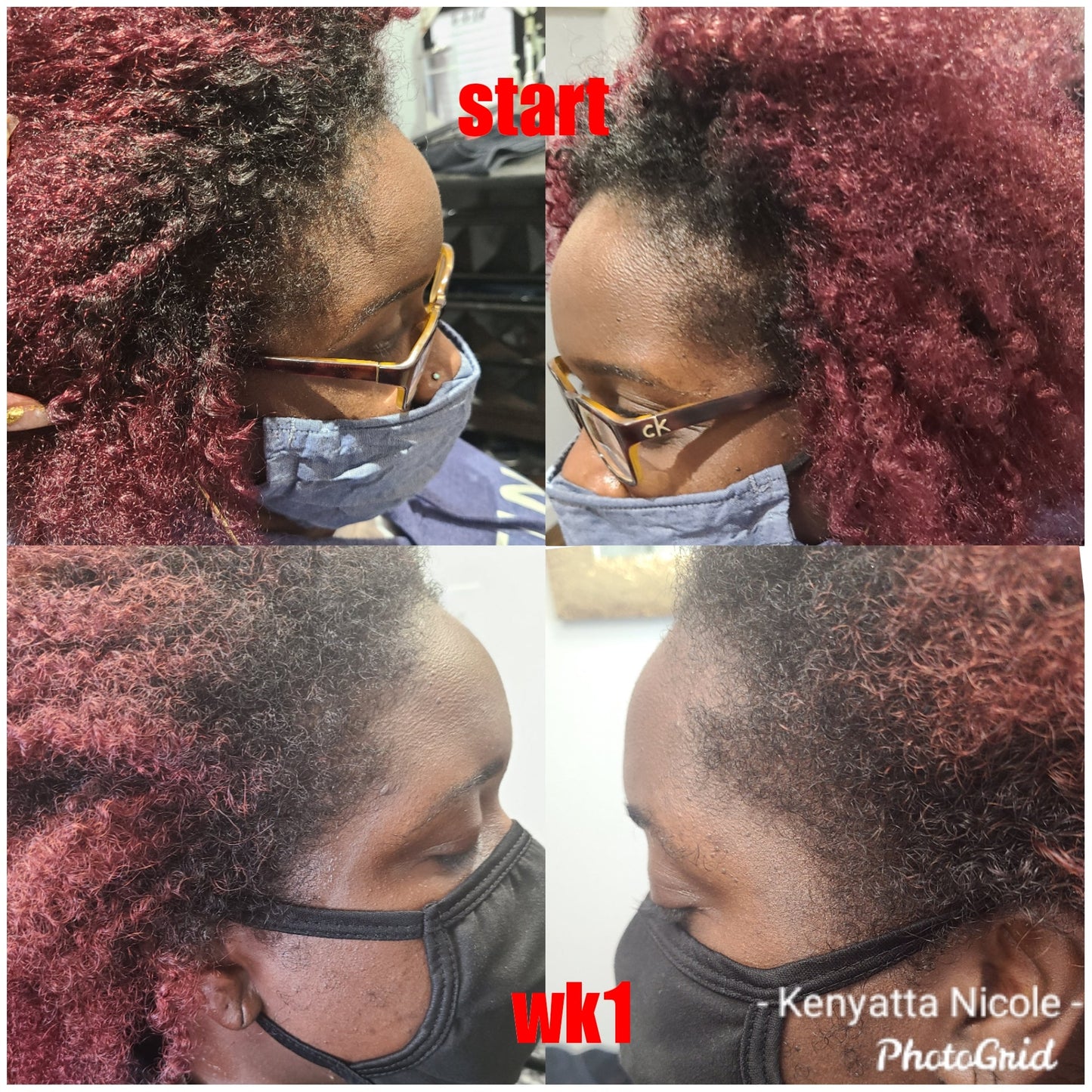 Nora Regrowth serum infused with over 25 essential oils. Helps with hair growth, edges and dry scalp. See Results in 7-14 days. Order yours today at www.theknstore.com to grow your hair and edges..